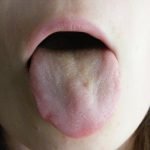 Clinical Training in Tongue Diagnosis